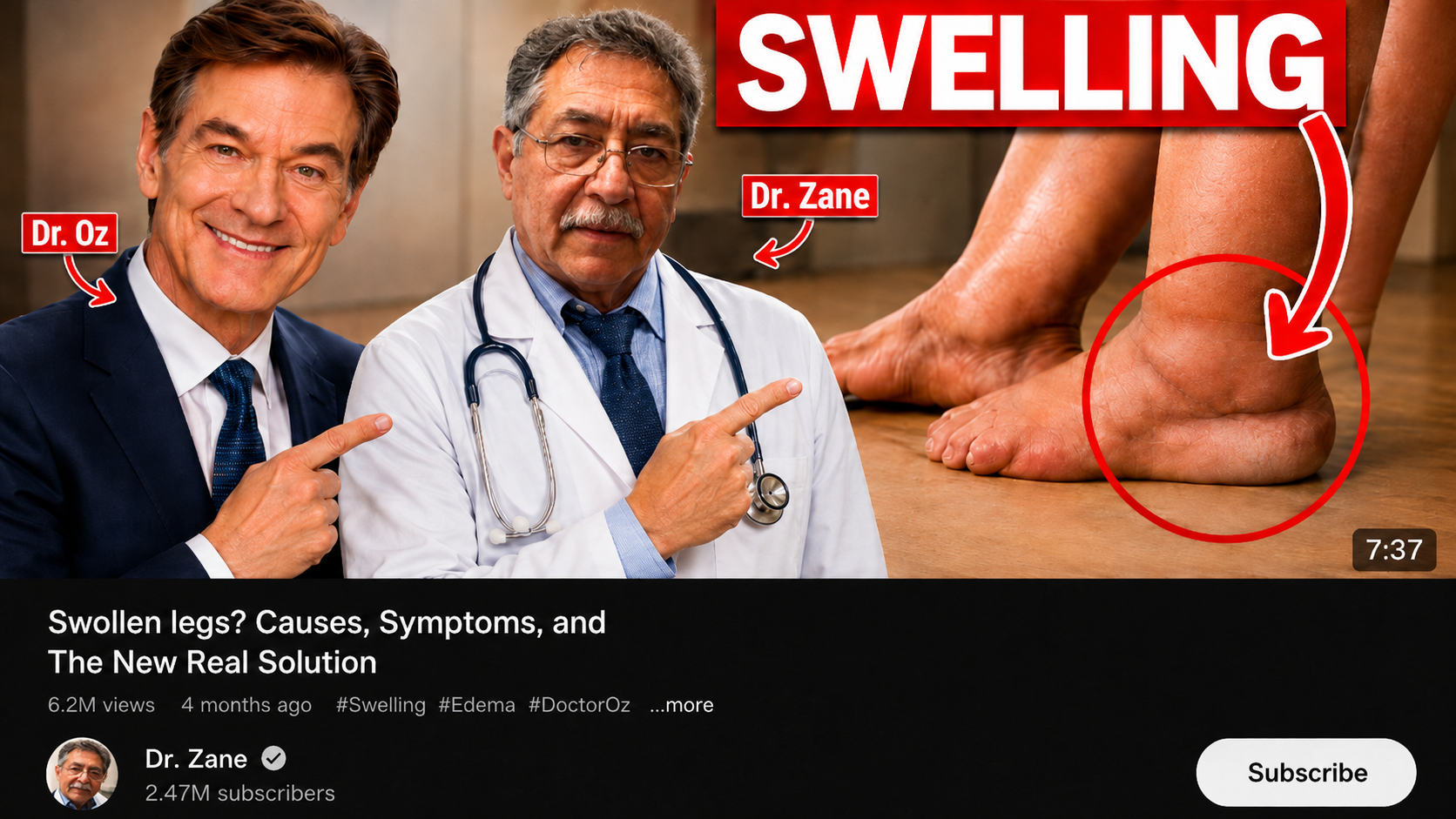 Dr. Zane discussing swollen legs